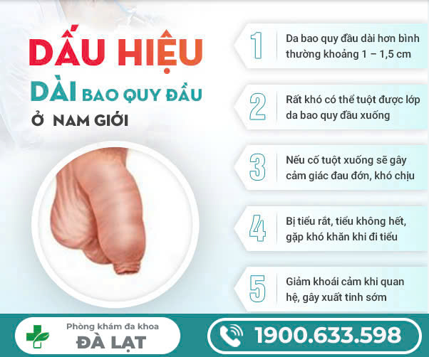 Hình ảnh minh họa